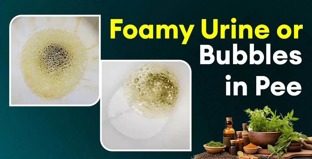 Foamy Urine or Bubbles In Pee Top 5 Causes You Should Know